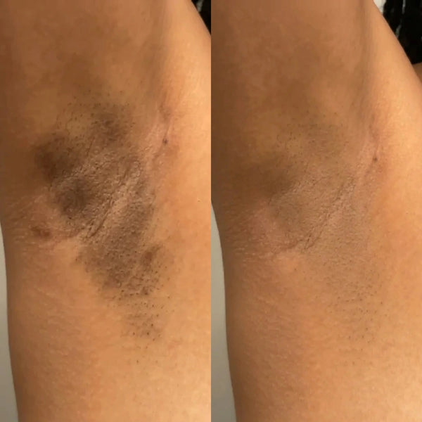 Skin you're not hiding anymore.